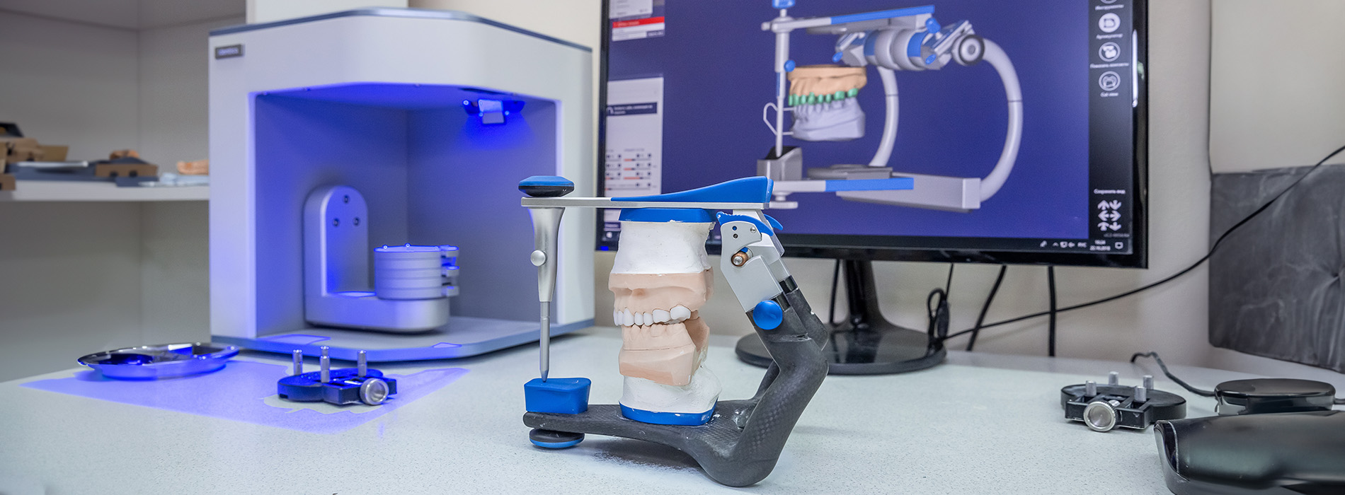 Minster Dental Care | Digital Radiography, Implant Restorations and Dental Bridges