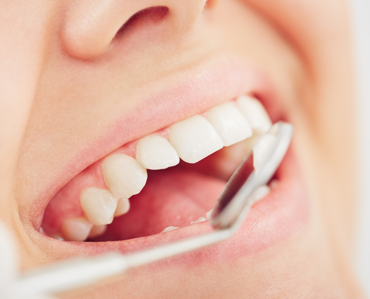 dentist-teeth-image