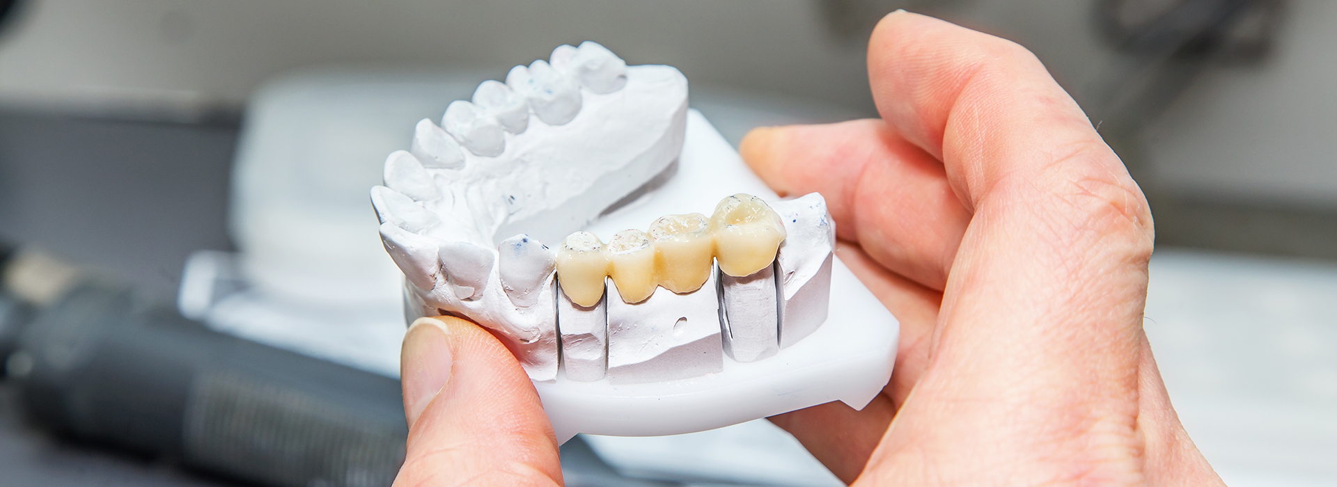Minster Dental Care | Pediatric Dentistry, SureSmile Aligners and Full Mouth Reconstruction