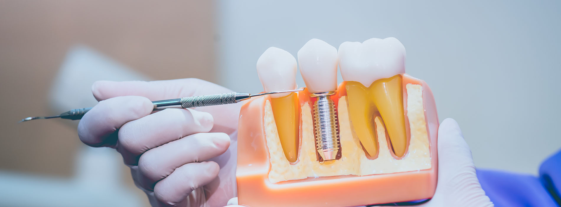 Minster Dental Care | Intraoral Camera, Soft Tissue Laser and Full Mouth Reconstruction